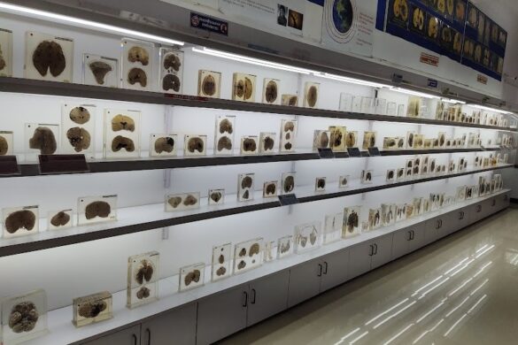 Nimhans Brain Museum Bengaluru - SillySuitcase